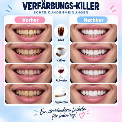 Busaurus™ - Aufhellende Zahnpasta mit Niacinamid